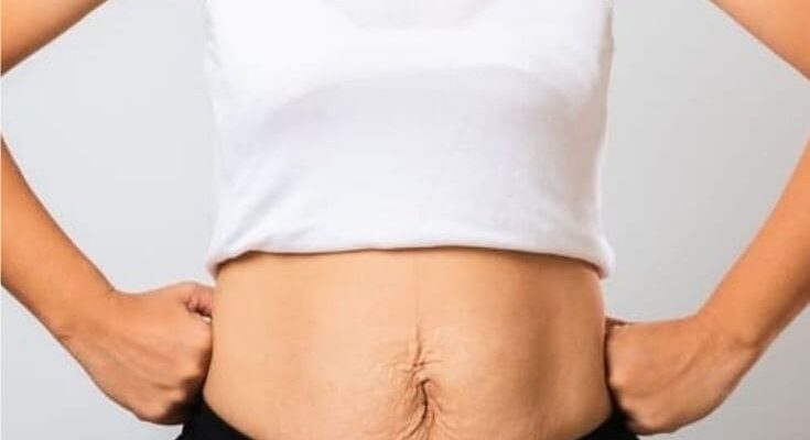 Best Shapewear for Lower Belly Pooch featured image